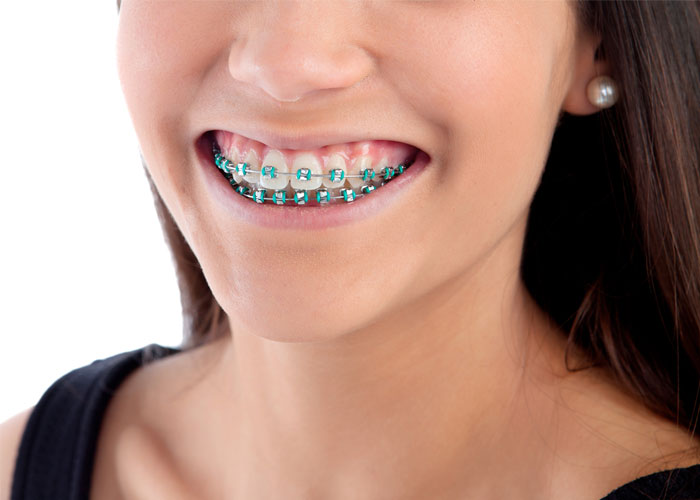 Imagen de boca con instrumentos odontológicos